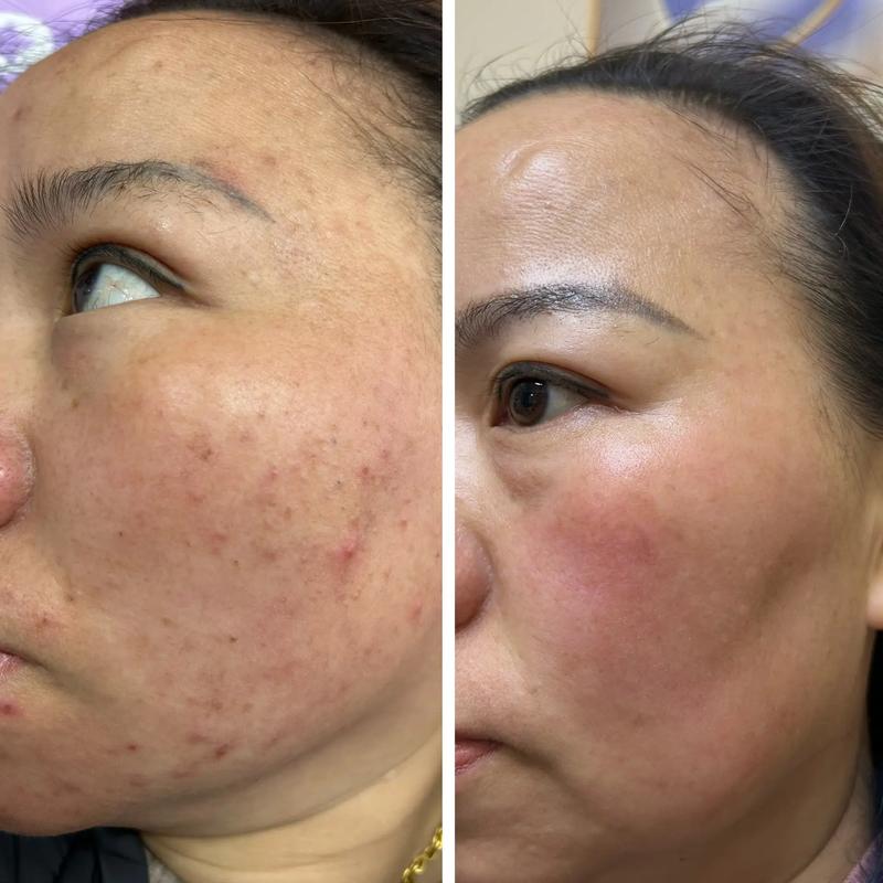 选对烟台美容院,美丽升级不再难