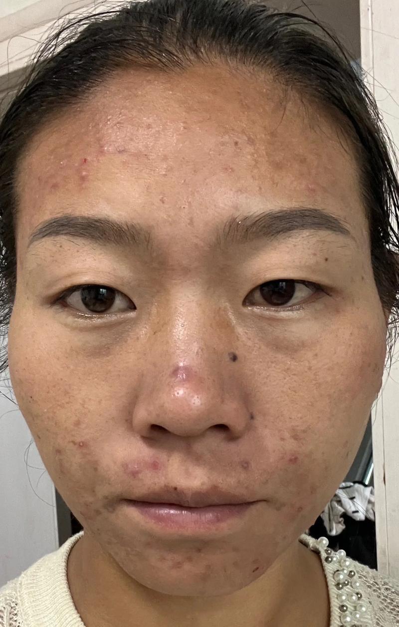 烟台美容行业新风尚:秀亚引领潮流