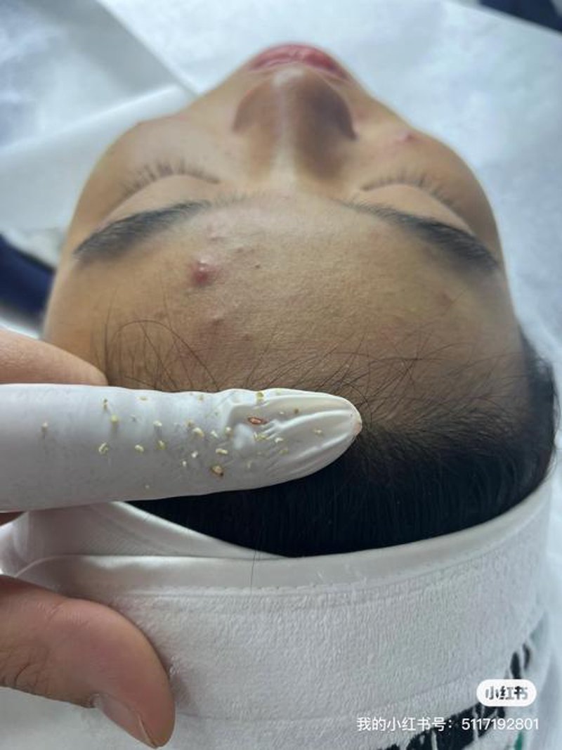 护肤知识更新：秋季面部护理新趋势